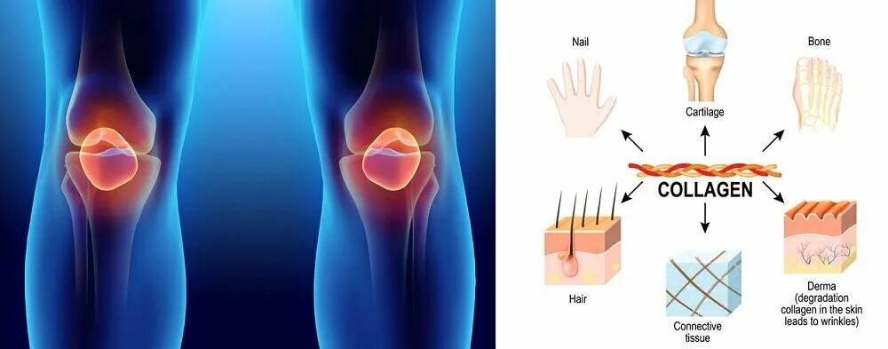 Коллаген для суставов. Коллаген для хрящей и суставов. Коллаген для костей и суставов. Коллаген для коленного сустава.