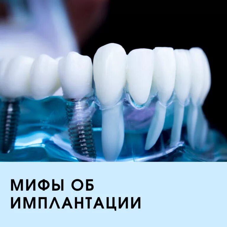Импланты в китае