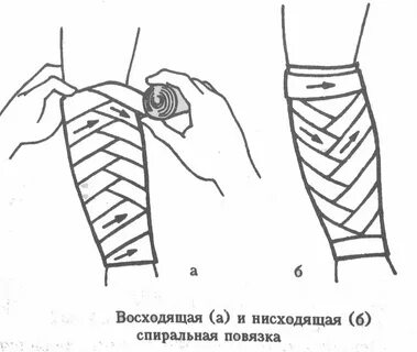 Наложение повязки на руку