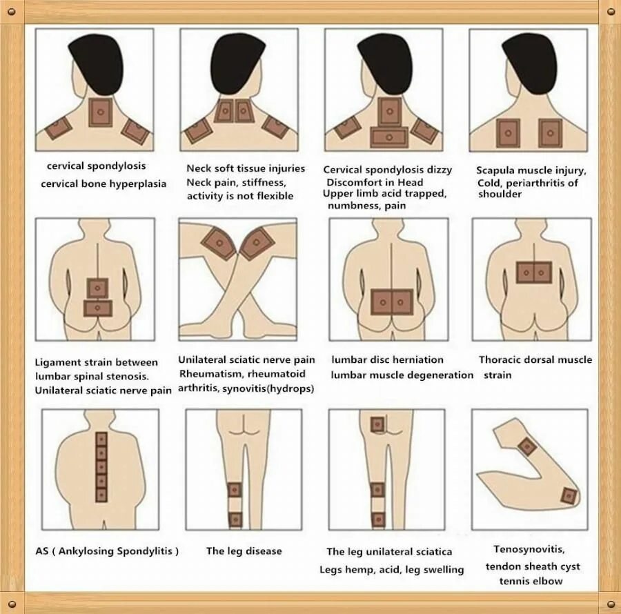 Правильно наклеить перцовый пластырь. Правильно приклеить перцовый пластырь. Перцовый пластырь схема наклеивания. Перцовый пластырь для спины.