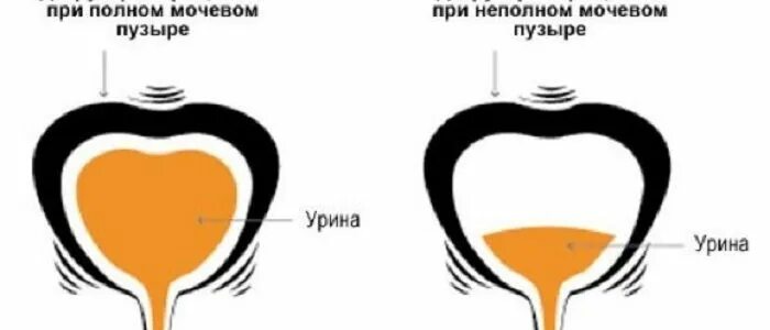 Вода попадает в мочевой пузырь через