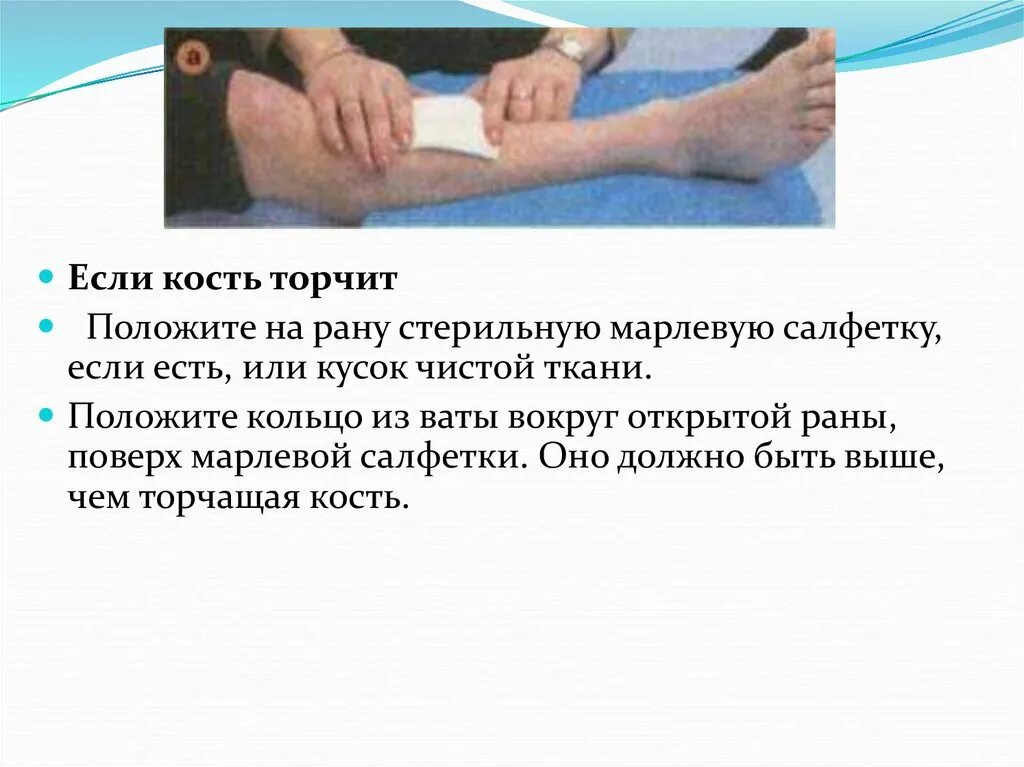 Закрытый перелом предплечья код по мкб 10. Резаная рана предплечья. переломы предплечья презентация. открыта рана предплечья.