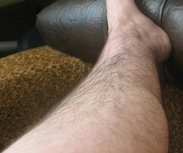 Волосатык мужскиетноги. Не ьритые женские ноги. Very hairy legs