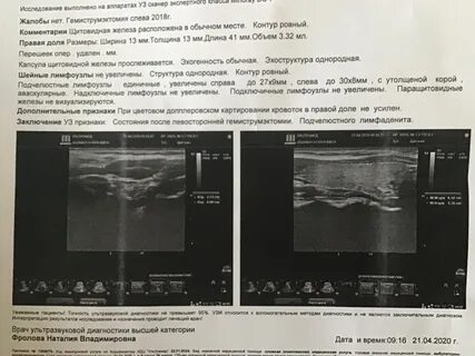Размеры лимфоузлов по узи