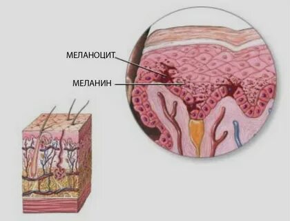 Клетки содержат пигмент меланин