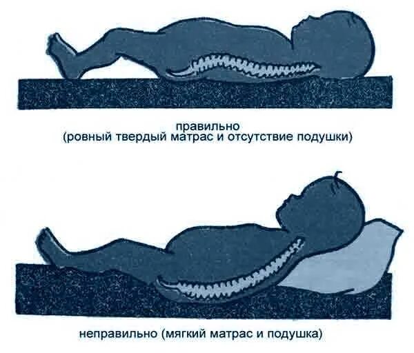 Новорожденному спать на боку или спине. Правильная поза для сна новорожденного. Правильное положение для сна. Правильное положение ребенка во сне. Положение для сна новорожденных.