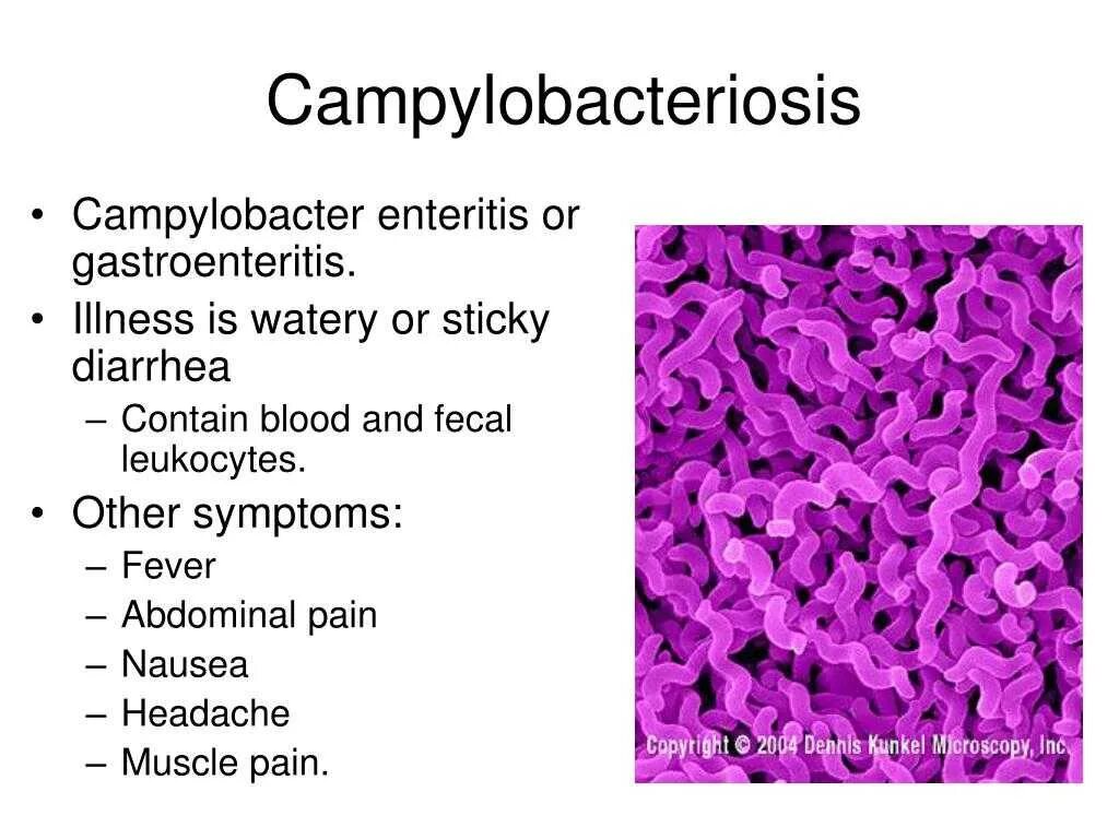 Кампилобактерии хеликобактерии. Кампилобактериоз энтероколит. Campylobacter jejuni микробиология. Кампилобактериоз у людей. Campylobacter jejuni микроскопия.