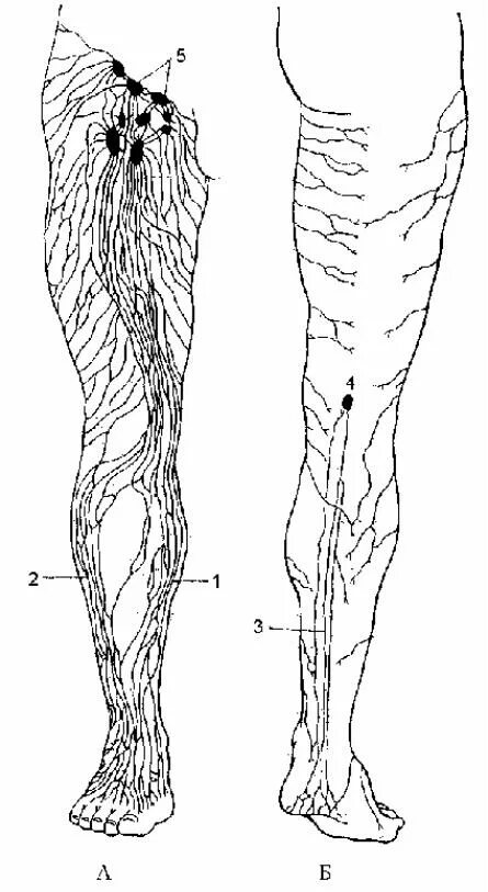 Поверхностные лимфатические узлы нижней конечности. Лимфоузлы коленного сустава схема. Поверхностные лимфатические сосуды нижней конечности. Лимфоузлы на ногах где