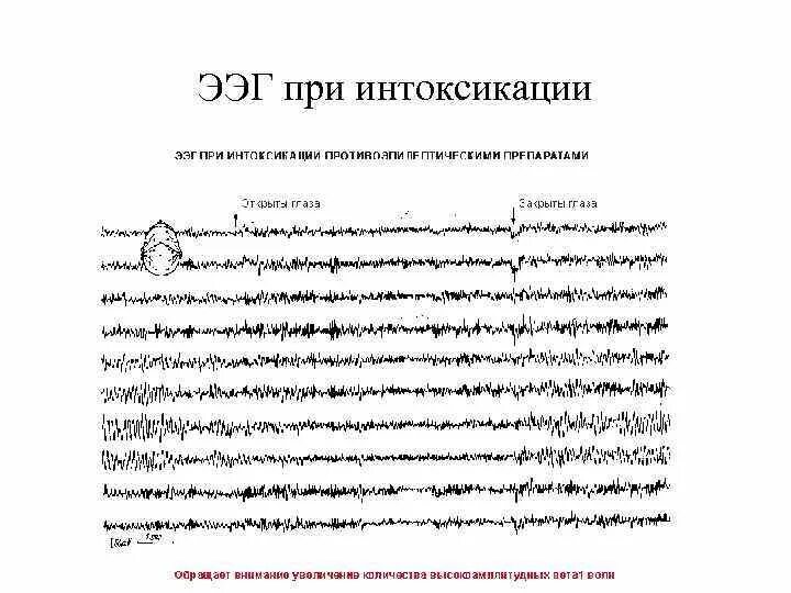 Расшифровка ээг у взрослого норма. Разработка ЭЭГ книги. Сущность метода ЭЭГ. ЭЭГ курсовая работа.