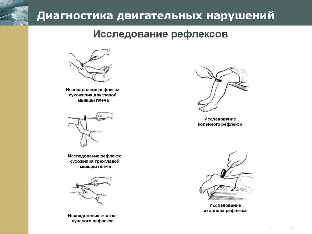 Двигательные рефлексы человека. Исследование сухожильных рефлексов. Исследование рефлексов верхней конечности. Исследование рефлексов неврология. Сухожильный рефлекс с двуглавой мышцы.