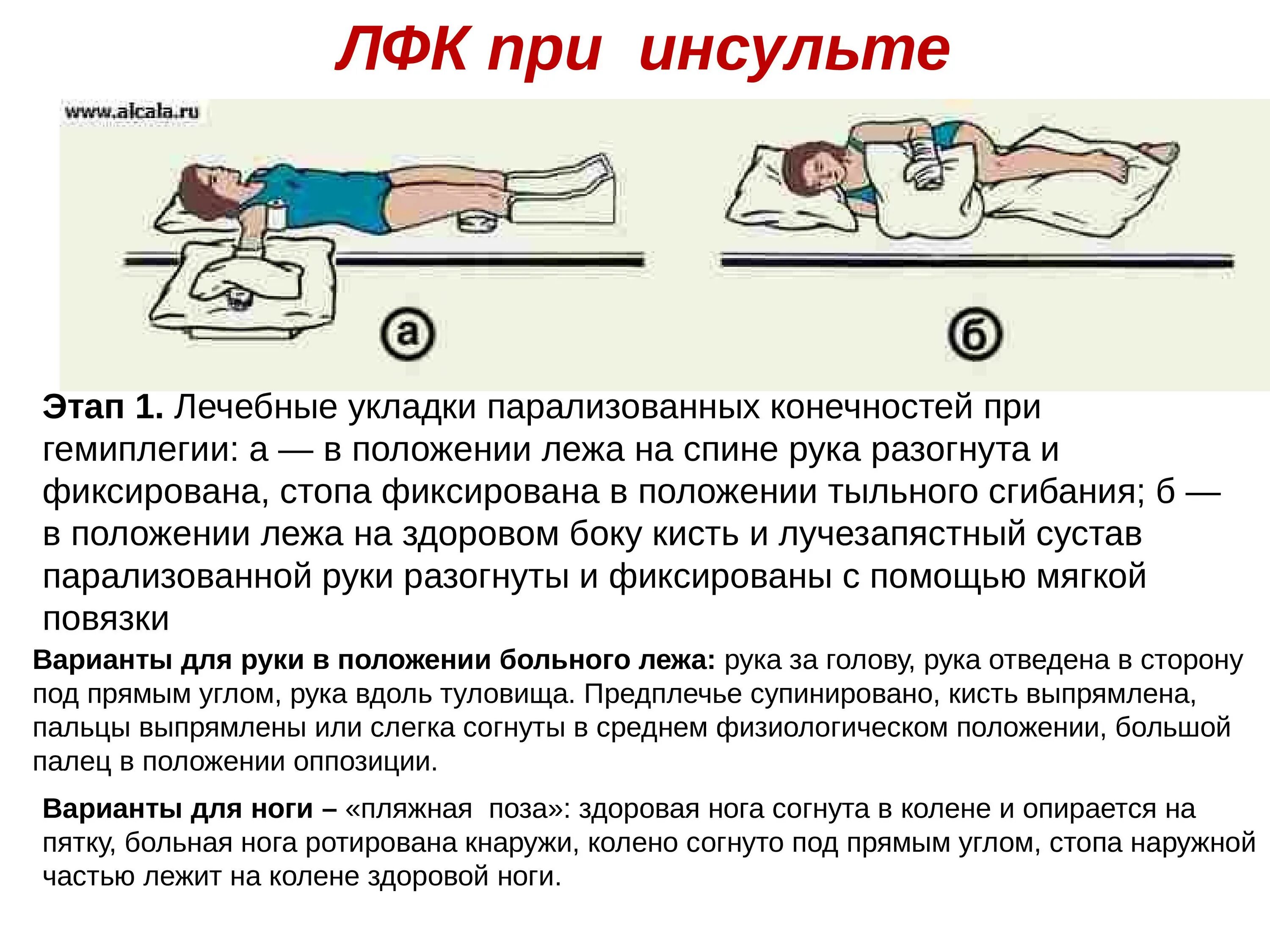 Инсульт как быстрее восстановиться. Комплекс упражнений для реабилитации после инсульта. Комплекс упражнений при реабилитации после инсульта. Лечебная физкультура после геморрагического инсульта. Комплекс ЛФК при нарушении мозгового кровообращения.