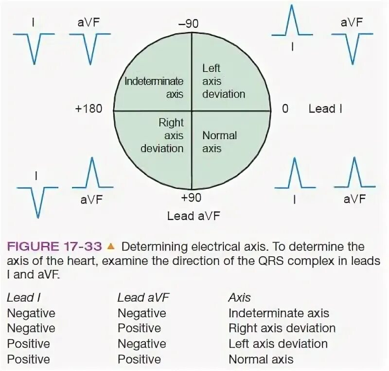 Mean axis. Heart axis. electrical axis of the heart. qrs axis. axis of heart parameters.