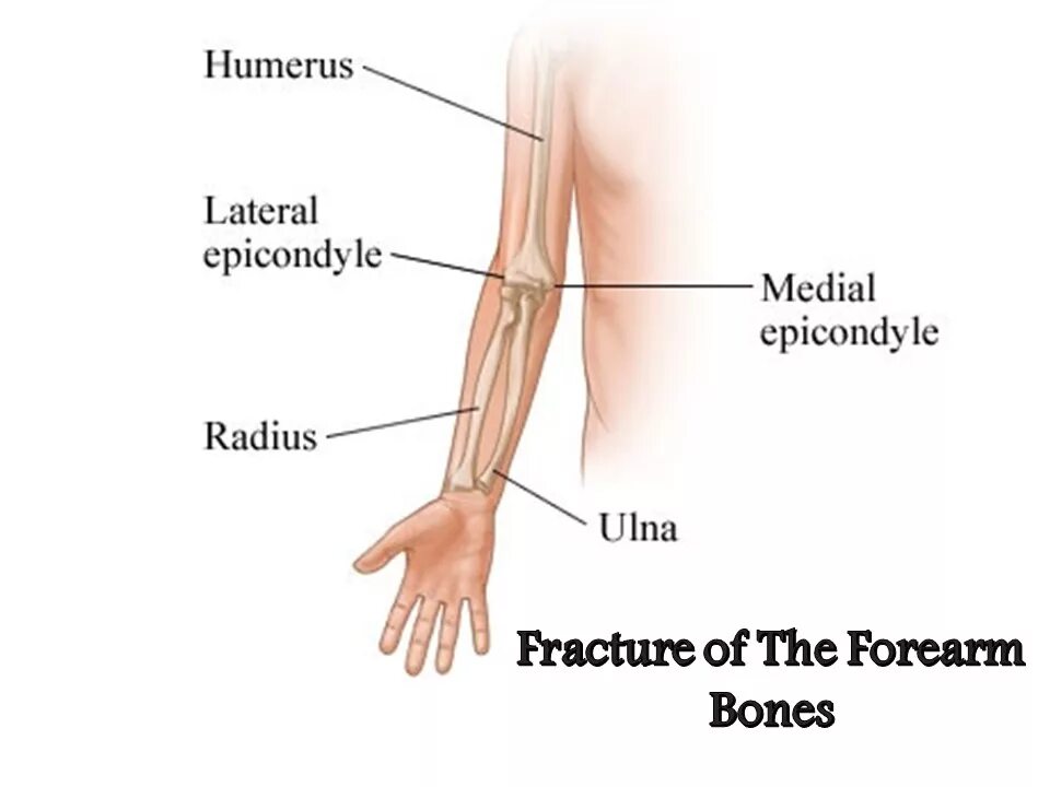 Forearm Bones. Ниже локтя как называется. Кость предплечья. Болят лучевые кости почему