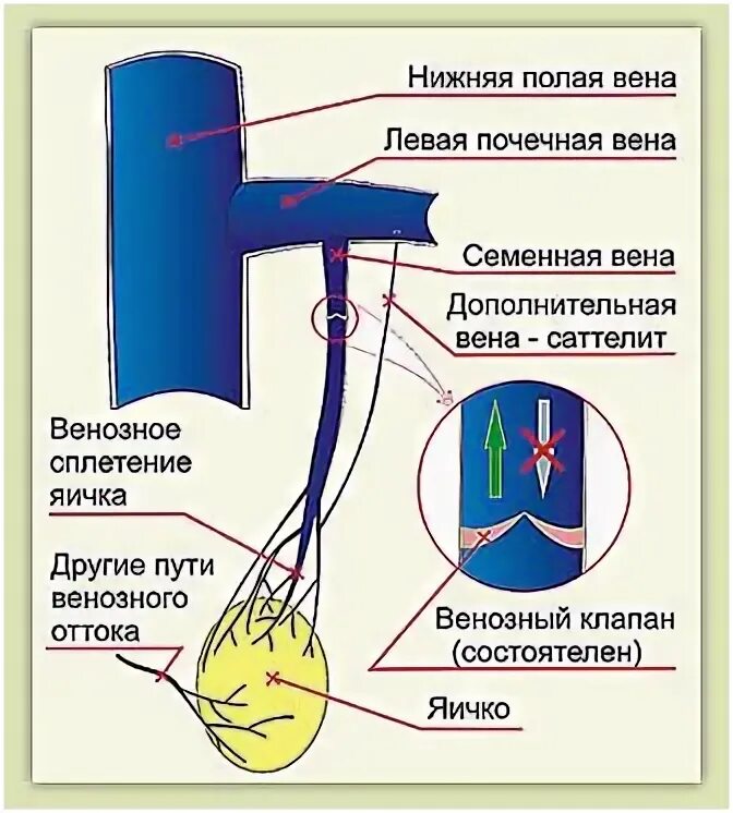 Венозное сплетение яичка. Венозный отток от яичка. Артерии яичка