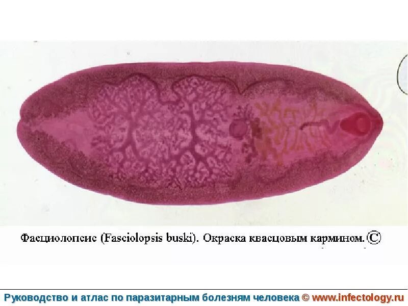 Печеночные сосальщики кишечник