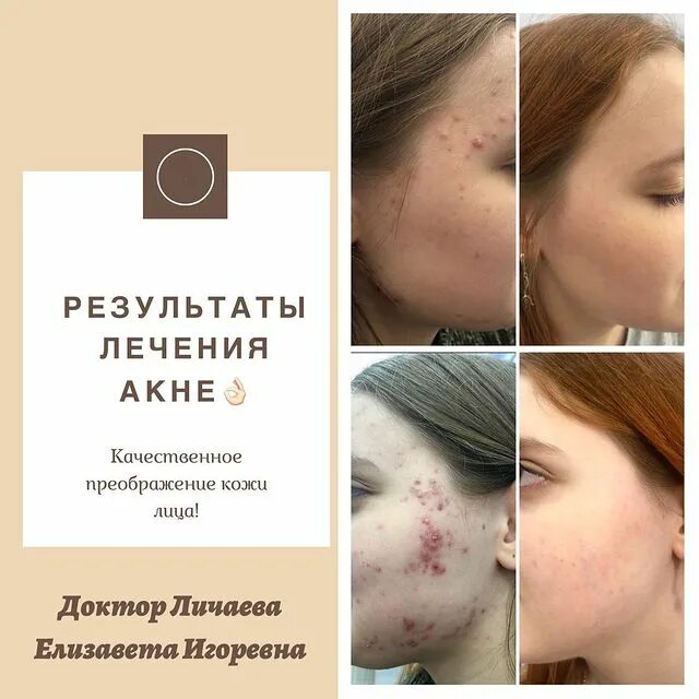 Black garlic cure. международная ассоциация трихологов. регистрация профессиональных ассоциаций.