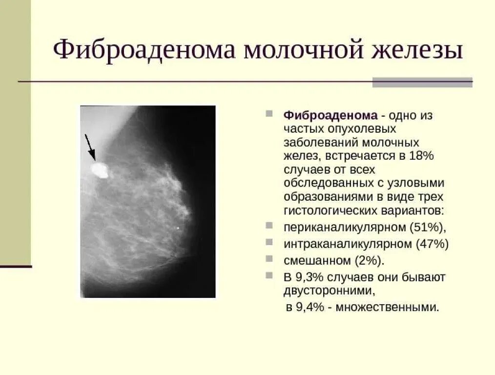 Плотный обнаружить