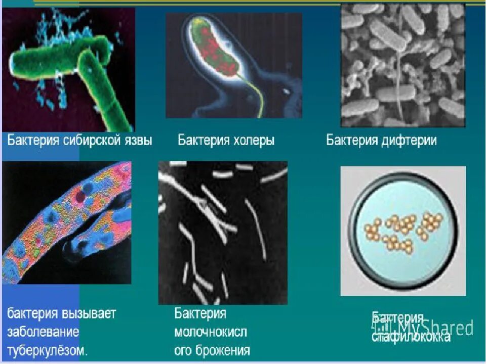 5 возбудитель чумы