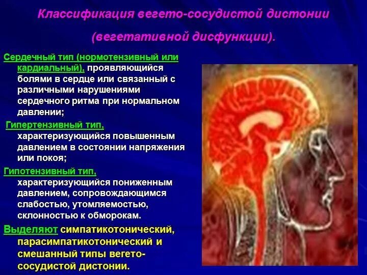 Типы вегетативной дисфункции. Классификация вегето-сосудистой дистонии. ВСД классификация. Кардиальный Тип ВСД. Вегето сосудистое расстройство нервной системы.