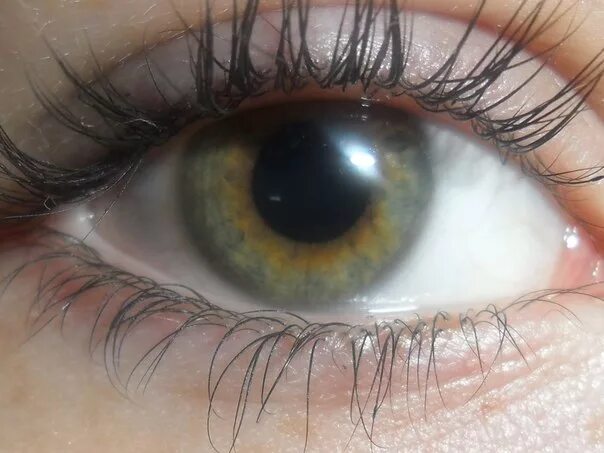 Папа карие глаза мама зеленые. Центральная гетерохромия глаз. Серо карие глаза. Серо зеленые глаза. Серо зелено карие глаза.