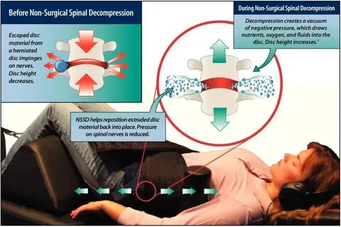 Decompression data