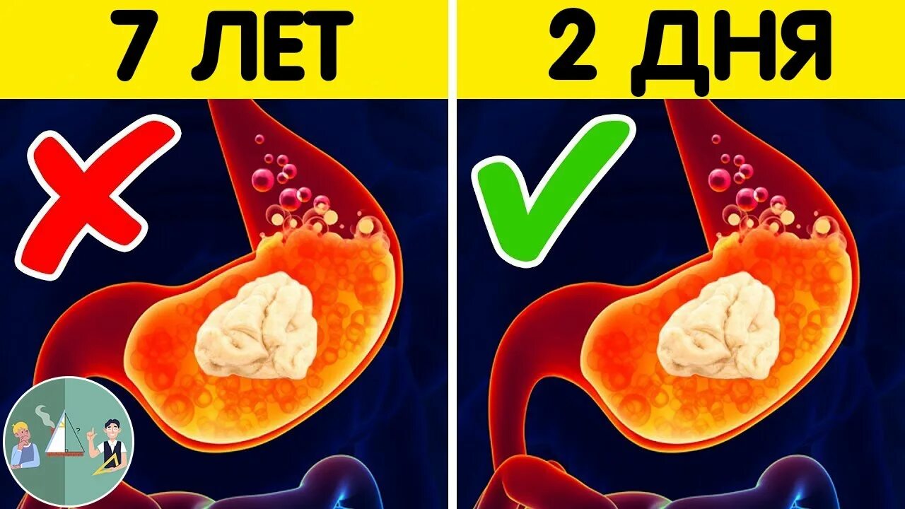 Что будет если глотать жвачку. Что будет если проглотить жвачку. Что будет если проглотить жвачку ребенку.