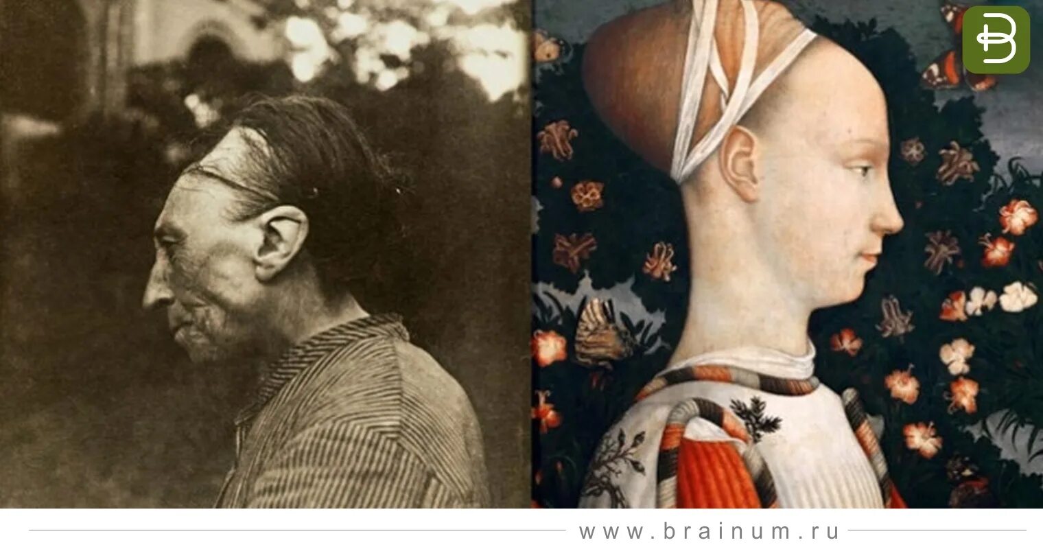 Он не может отличить красоту от уродства. Тулузская деформация головы. Портрет Джиневры д Эсте. Люби с вытенутими черепами. Люди с вытянутыми черепами.