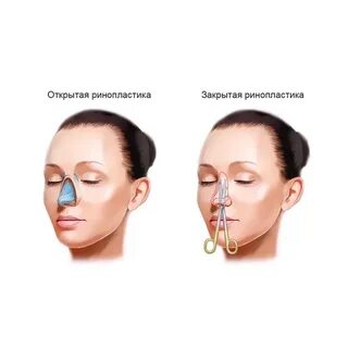 Как открыть нос