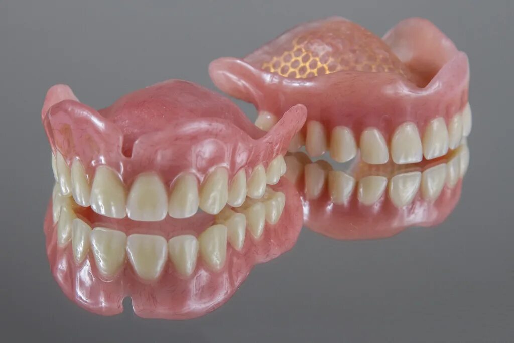 Зубные протезы нового поколения цена. Prothese dentaire.