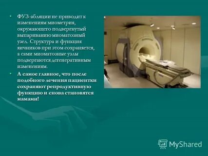Фуз миомы