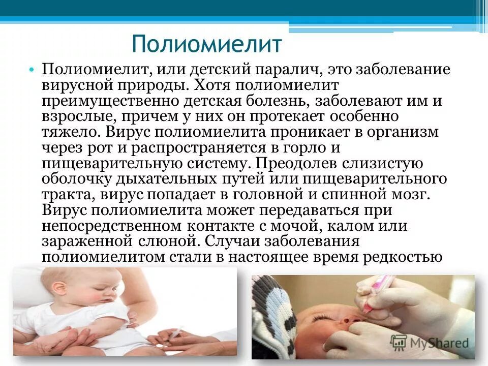 Как делается полиомиелит. Полиомиелит прививка. привикаот полиомиелита. полиомиелит у детей вакцинация. прививка от полиомиелита детям.