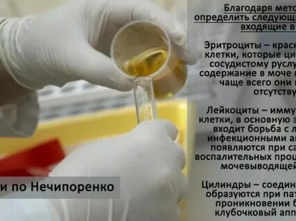 Как собрать анализ по нечипоренко взрослому CompanySec.ru