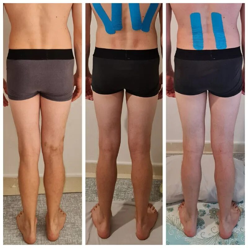 Skyrim зелье здоровья. Код в скайриме на вес. Индекс массы тела. Повышение переносимого веса. Инфографика бег.