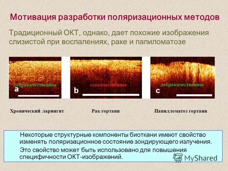 Основные технические характеристики рлс. Виды зондирующих сигналов. Зондирующее излучение. Рассеивание лазерного излучения. Зондирующее излучение.