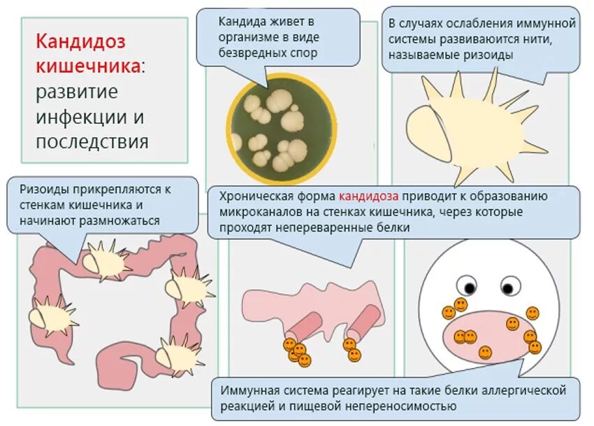 Метеоризм слизь