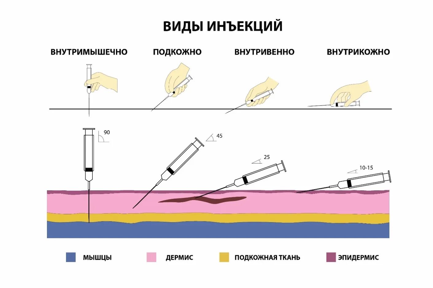 Угол введения иглы при внутрикожной инъекции. Угол наклона иглы при внутримышечной инъекции. Угол наклона иглы при внутривенных инъекциях:. Правила введения инъекций всех видов.