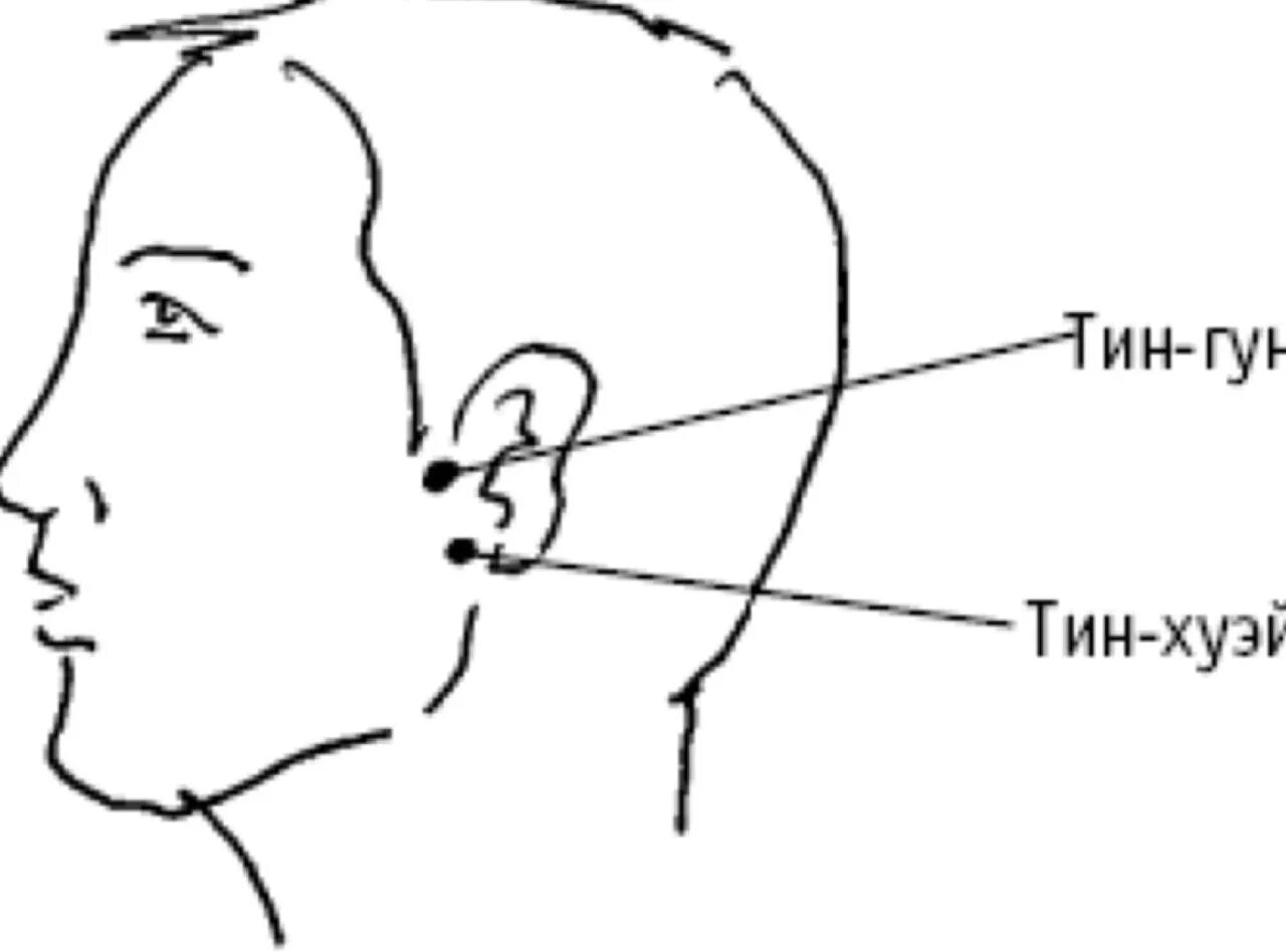 Точки шум в ушах. Тин Хуэй точка акупунктуры. Тин Гун точка акупунктуры. Точка Тин-Хуэй для улучшения слуха. Точка Тин Хуэй vb 2.