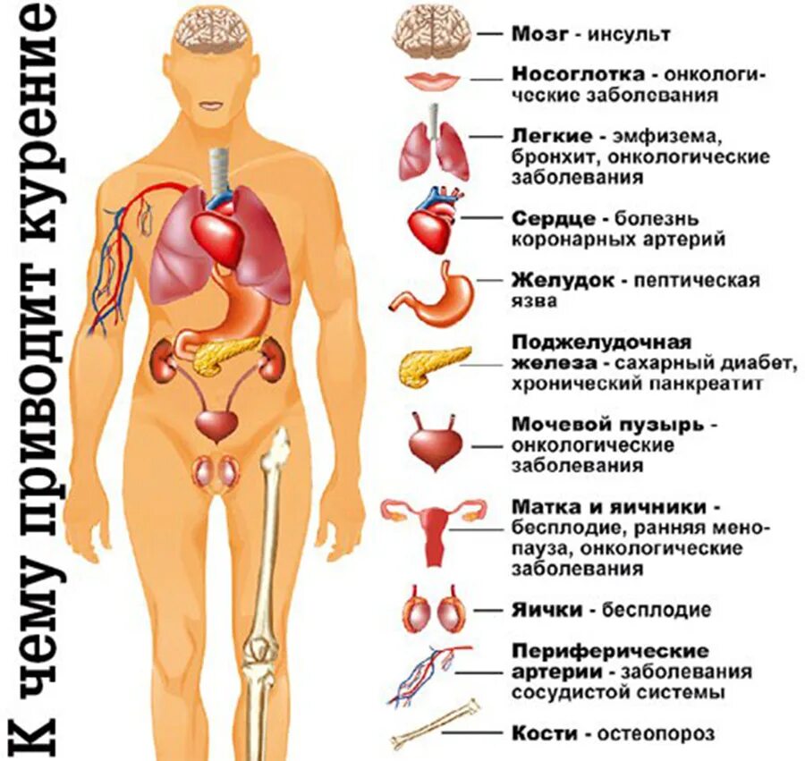 болезни вызванные курением. курение причина каких заболеваний. болезни от табакокурения. какие заболевания от курения. болезни вызванные кремнием.