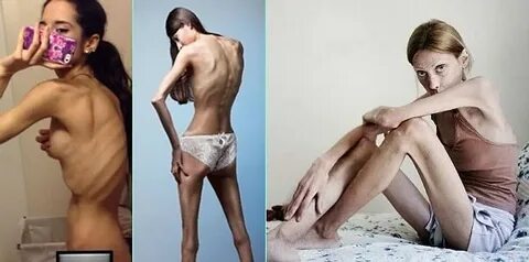 Obektlar bilan eshakda sikilgan odamning fotosurati