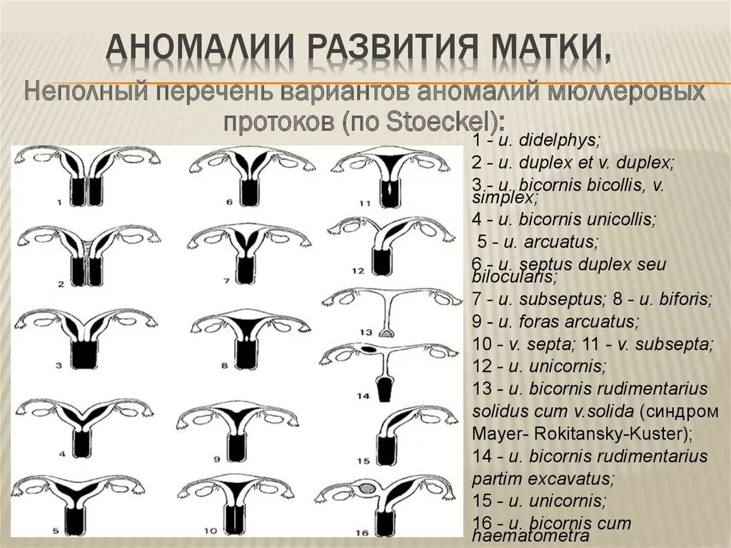 Классификация пороков развития матки по Адамян. Аномалии развития матки. Аномалии развития матки классификация. Врожденные пороки развития матки.