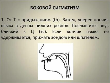 Что такое сигматизм