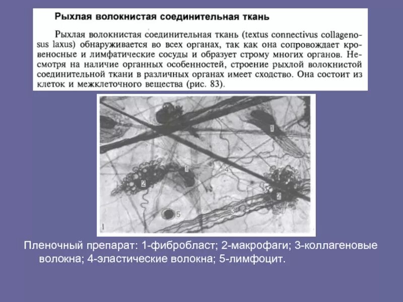 Клеточный состав рыхлой соединительной ткани. Клетки рыхлой соединительной ткани. рыхлая соединительная ткань. рыхлая соединительная ткань фото. рыхлая соединительная ткань особенности строения.