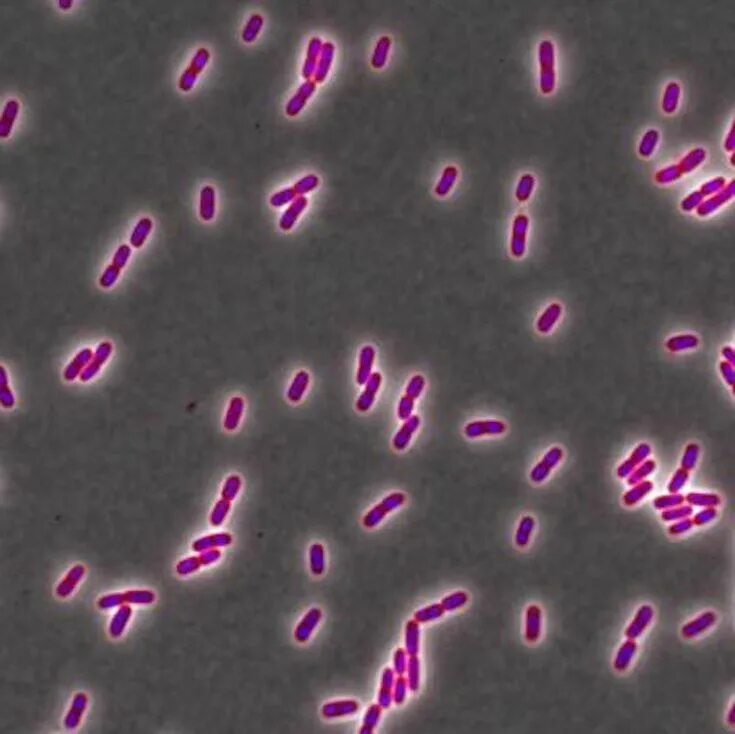 Listeria rj. Листерия моноцитогенес микробиология. listeria monocytogenes микроскопия. бактерии листерии. листерии по левадити.