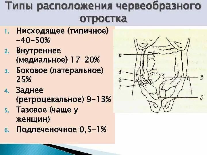 Ретроцекальный аппендицит. Расположение ччервеообразнгого отрос тка. Положения червеобразного отростка. Расположение аппендикулярного отростка. Локализация острого аппендицита