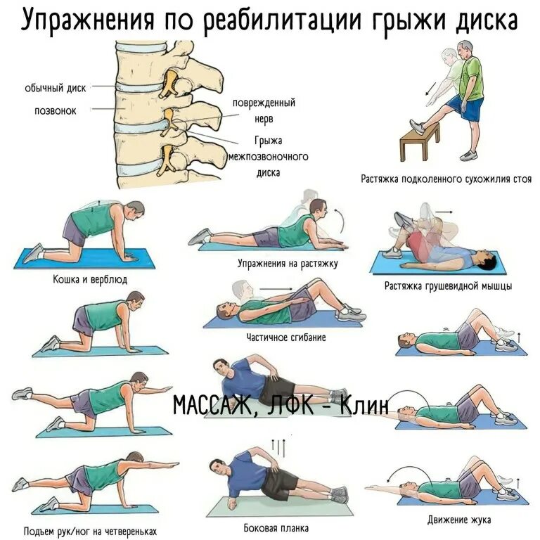 Упражнения для позвоночных грыж. Упражнения при протрузиях поясничного отдела. Гимнастика при грыже пояснично-крестцового отдела. Грыжа диска лфк. Грыжа диска лфк.
