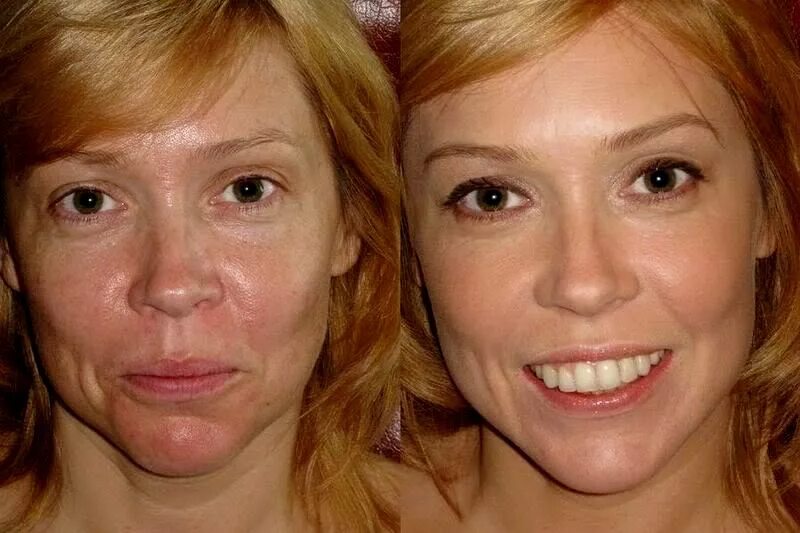 Когда ее лицо становилось лучше. Тональный крем до и после.