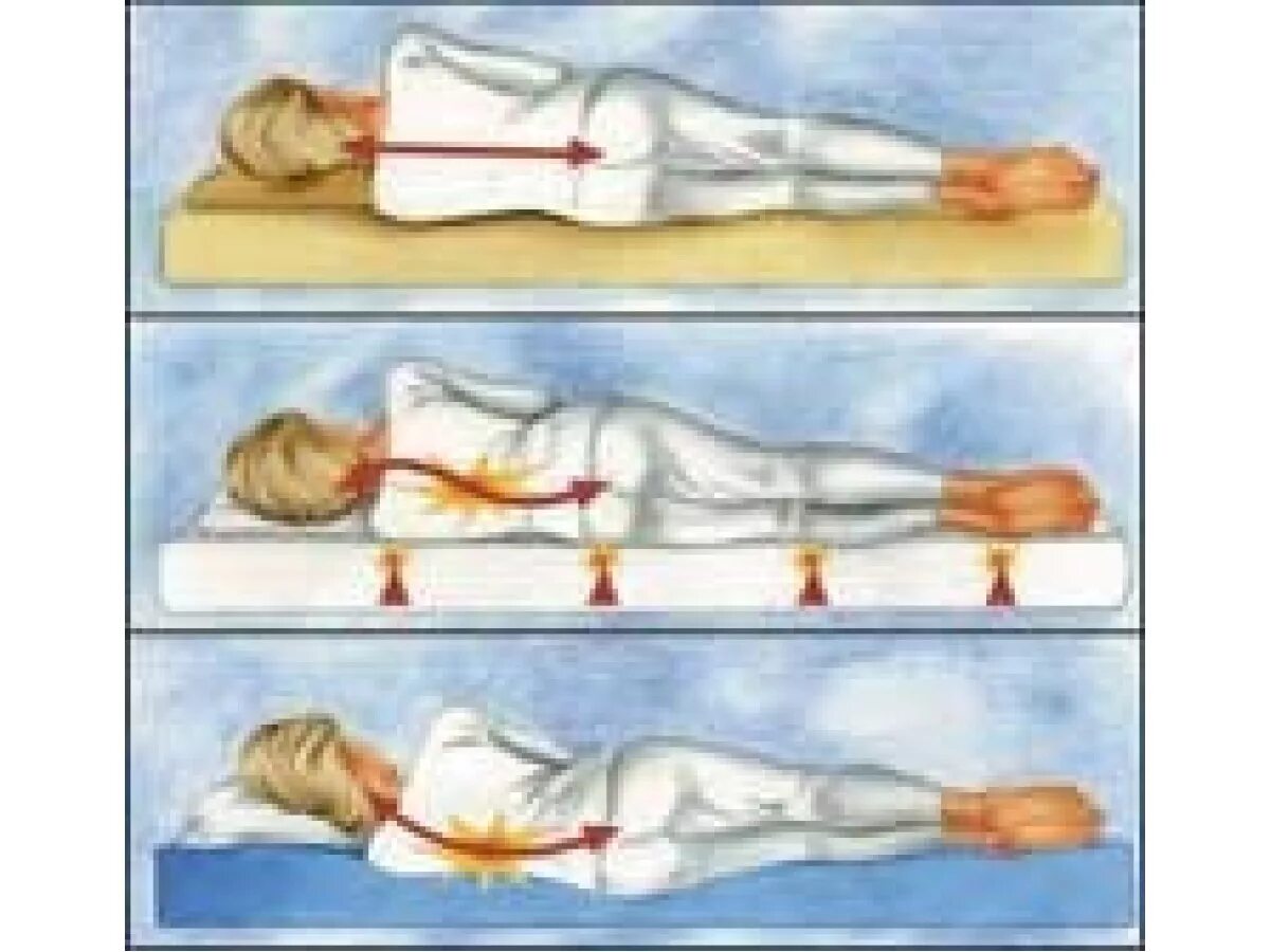 Остеохондроз спать без подушки. Положение позвоночника на мягком матрасе. Сон на полу при сколиозе. Мягкий матрас для спины. Как правильно спать на полу.