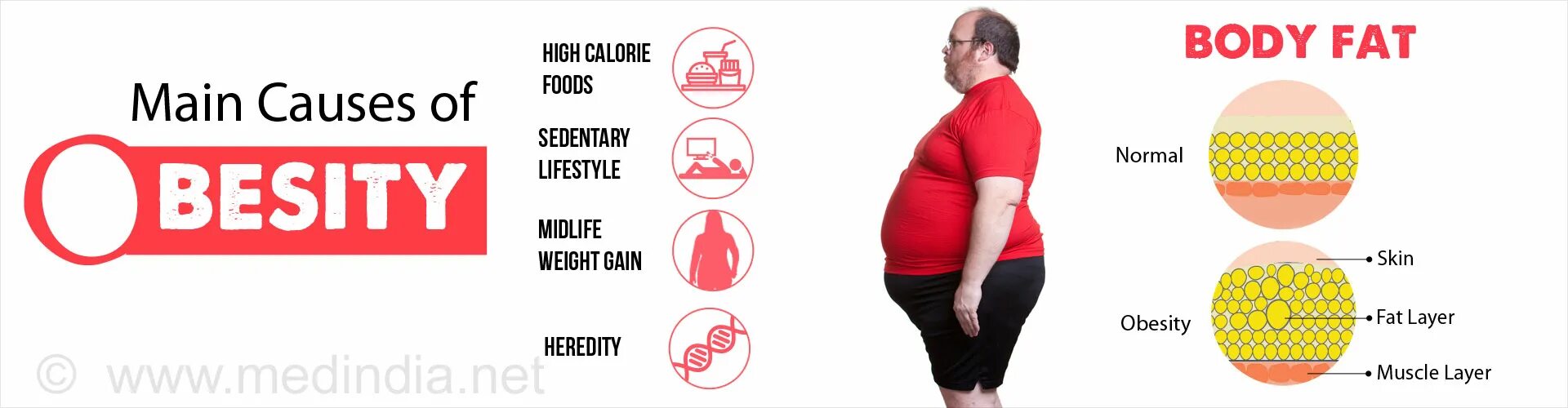 Fat body транскрипция. Fat body перевод. Fat body 3 класс. Main causes of obesity. Перевести на русский bodies