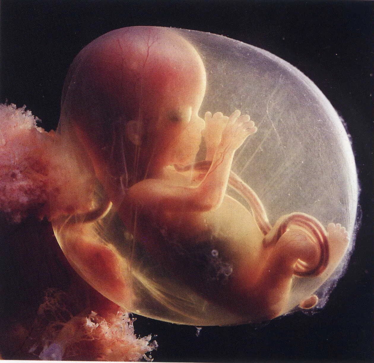Плод в 15 недель беременности. Эмбрион на 17 неделе беременности. Эмбрион на 14 неделе беременности. 13-14 Недель беременности фото плода.