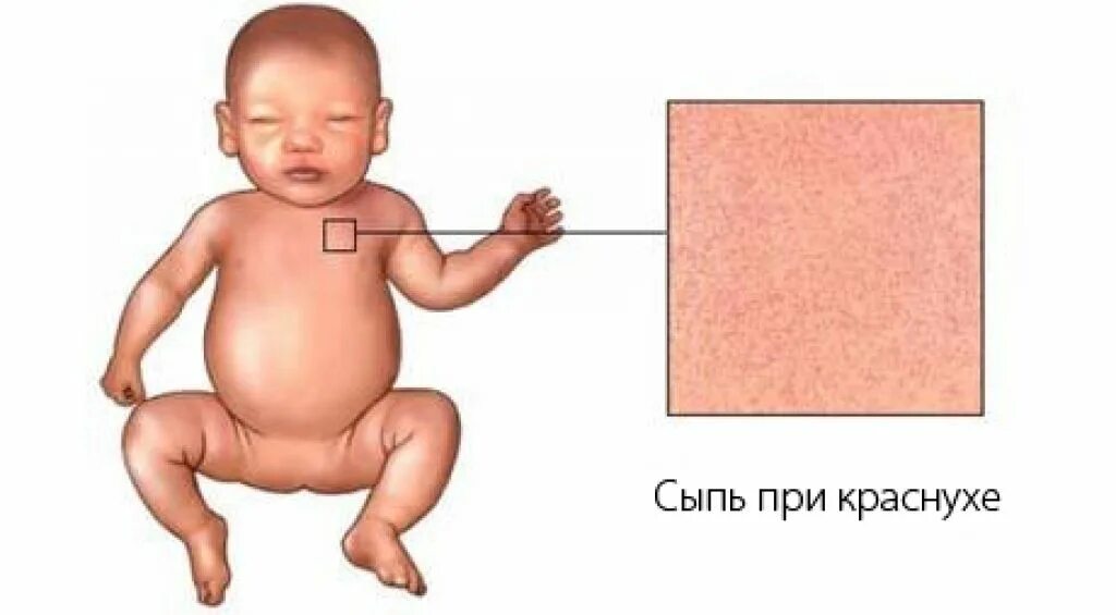 Типа у ребенка форум